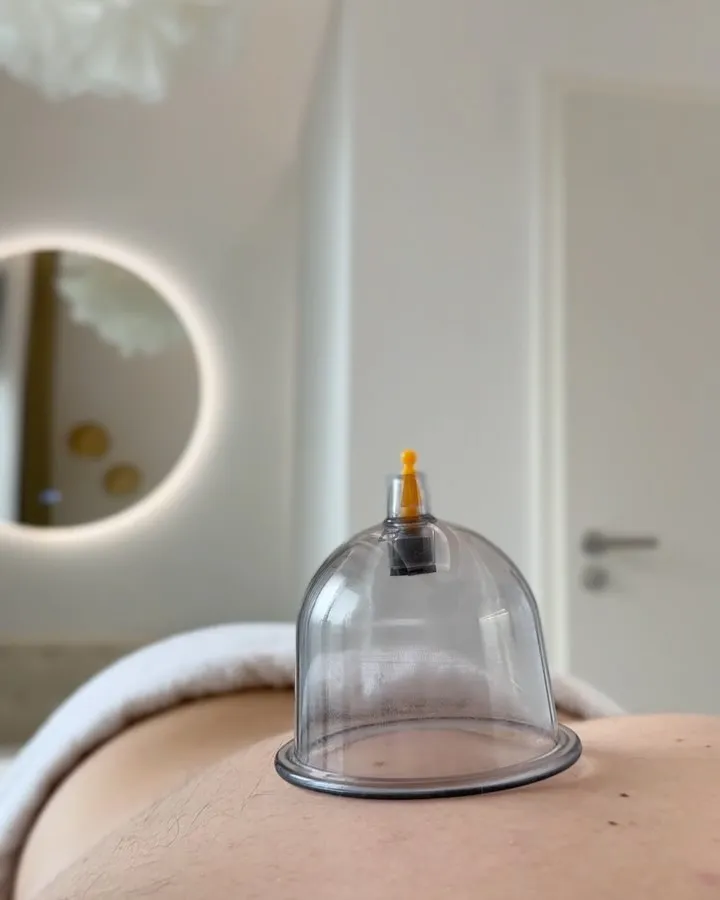 Banková masáž – sklenená banka na chrbte klientky